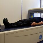Osteoporose Bichos de sete cabeças