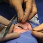 cirurgia inédita em Israel
