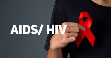 Universidade tratamento para AIDS